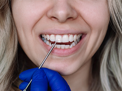 Green Ridge Dental Care | Night Guards, Oral Exams and Root Canals