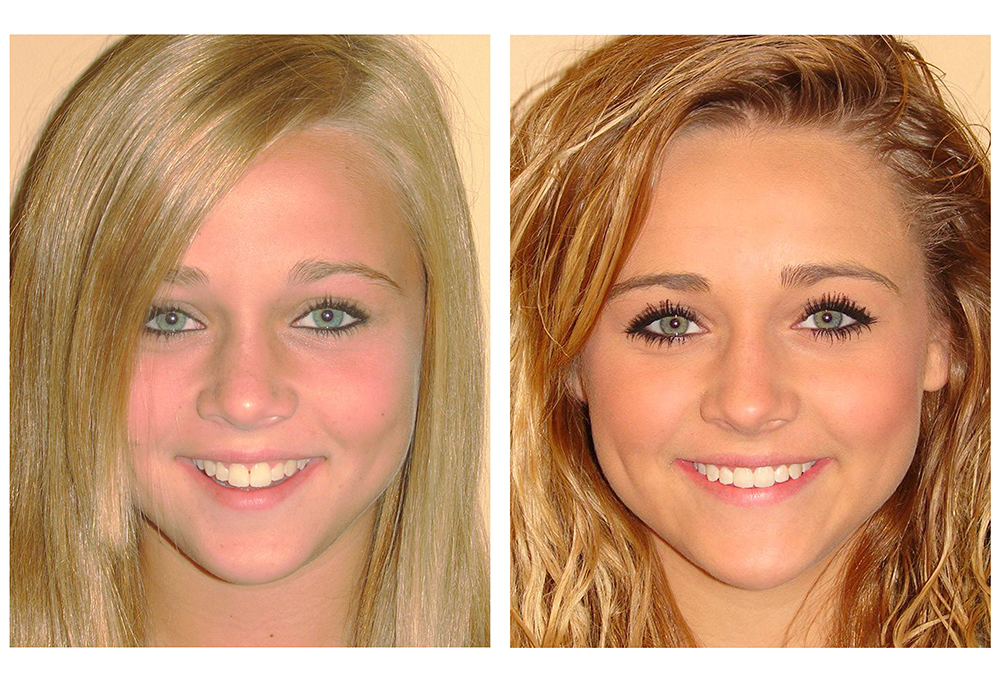 Green Ridge Dental Care