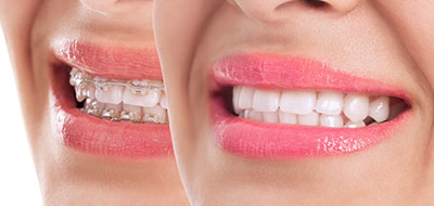 Green Ridge Dental Care | Teeth Whitening, Periodontal Treatment and Cosmetic Dentistry