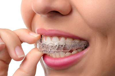 Green Ridge Dental Care | Ceramic Crowns, Sleep Apnea and Dentures