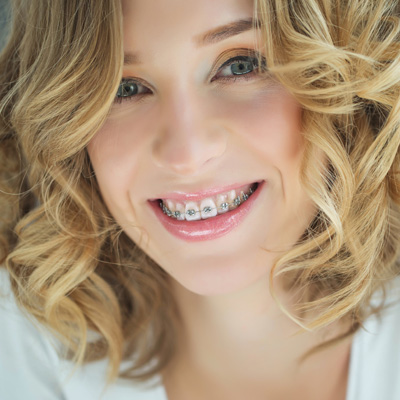 Green Ridge Dental Care | Preventative Program, Ceramic Crowns and Teeth Whitening