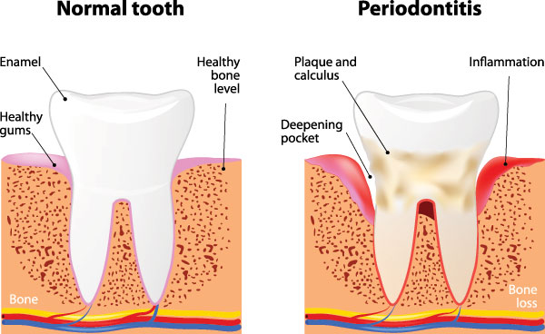 Green Ridge Dental Care | Cosmetic Dentistry, Periodontal Treatment and Dental Fillings